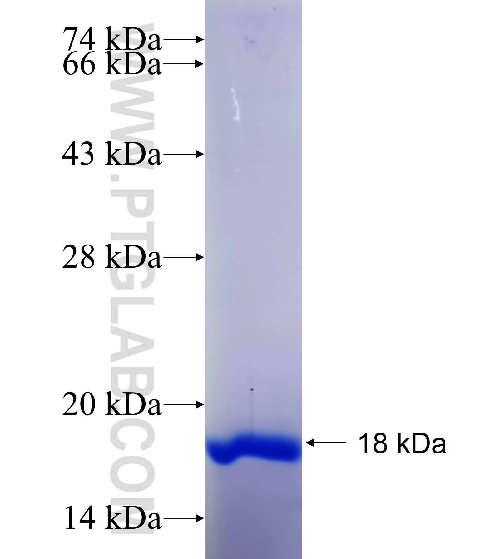ZIC2 fusion protein Ag35844 SDS-PAGE