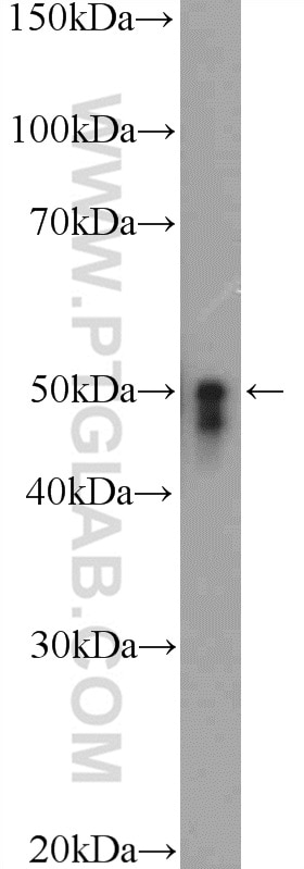 WB analysis of SH-SY5Y using 21717-1-AP