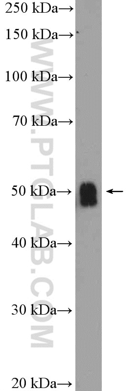 Western Blot (WB) analysis of mouse cerebellum tissue using ZIC3 Polyclonal antibody (21717-1-AP)