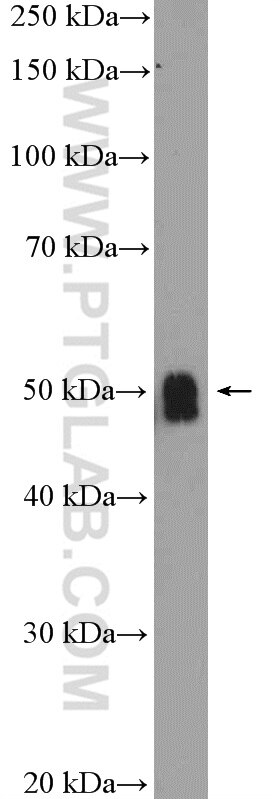 Western Blot (WB) analysis of mouse cerebellum tissue using ZIC3 Polyclonal antibody (21717-1-AP)