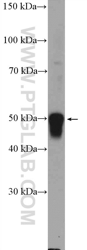 Western Blot (WB) analysis of SH-SY5Y cells using ZIC3 Polyclonal antibody (21717-1-AP)