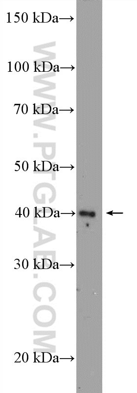 Western Blot (WB) analysis of Y79 cells using ZIC3 Polyclonal antibody (21717-1-AP)