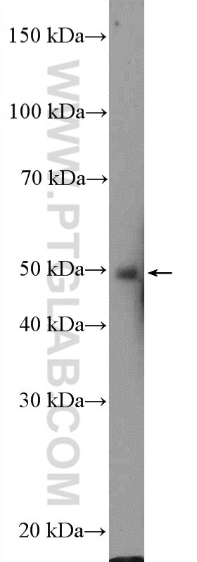 Western Blot (WB) analysis of Neuro-2a cells using ZIC3 Polyclonal antibody (21717-1-AP)
