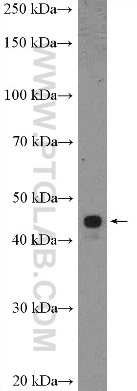 Western Blot (WB) analysis of SH-SY5Y cells using ZIC3 Polyclonal antibody (21717-1-AP)
