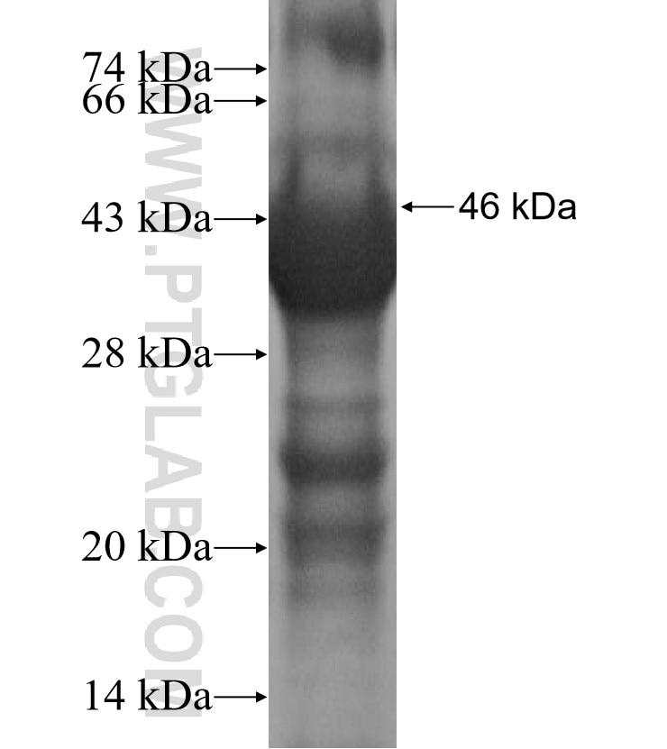 ZIC3 fusion protein Ag16354 SDS-PAGE