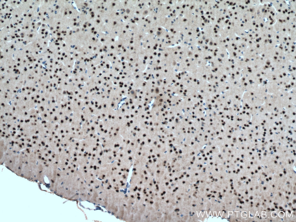 Immunohistochemistry (IHC) staining of mouse brain tissue using ZIC4-Specific Polyclonal antibody (51003-1-AP)