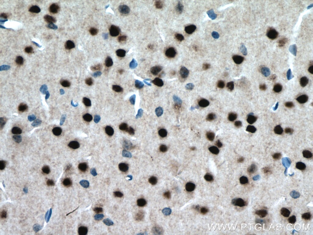 Immunohistochemistry (IHC) staining of mouse brain tissue using ZIC4-Specific Polyclonal antibody (51003-1-AP)
