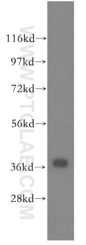 Western Blot (WB) analysis of human brain tissue using ZIC4-Specific Polyclonal antibody (51003-1-AP)