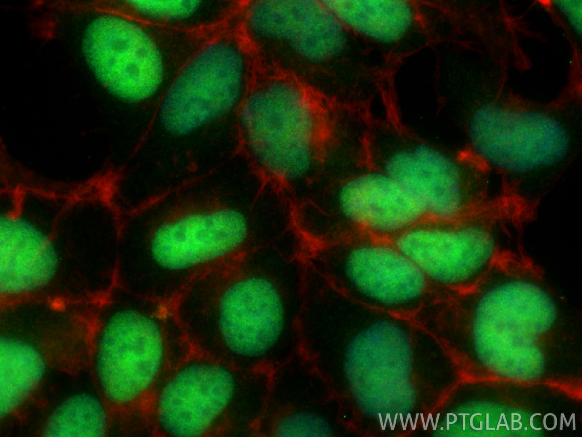 IF Staining of HEK-293 using 34277-1-AP (same clone as 34277-1-PBS) Immunofluorescence (IF) / fluorescent staining of HEK-293 cells using ZIC5 Polyclonal antibody (34277-1-AP)
