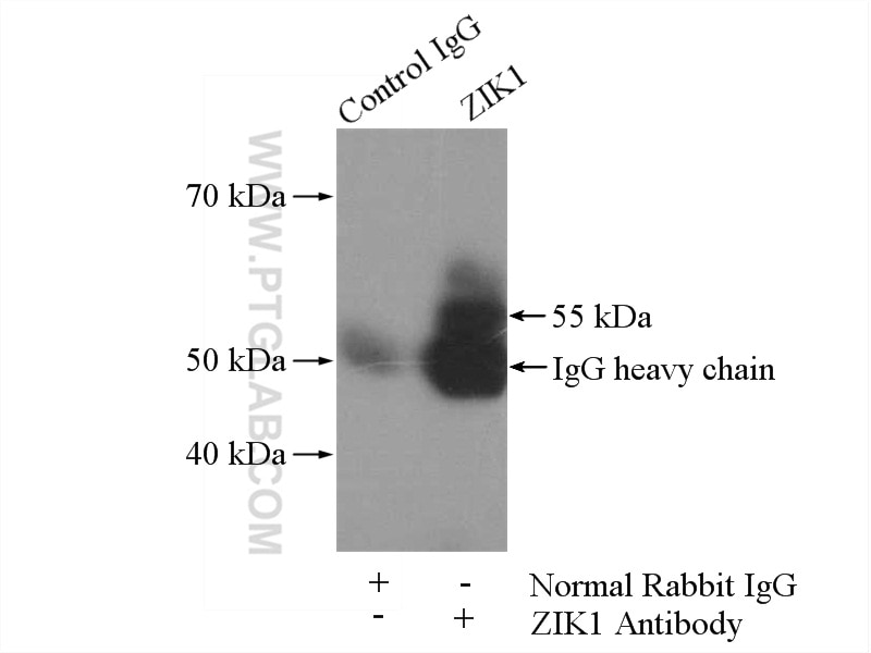 Immunoprecipitation (IP) experiment of Jurkat cells using ZIK1 Polyclonal antibody (21934-1-AP)
