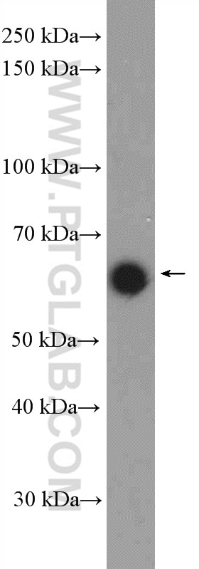 Western Blot (WB) analysis of Jurkat cells using ZIK1 Polyclonal antibody (21934-1-AP)