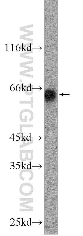 Western Blot (WB) analysis of COLO 320 cells using ZIM3 Polyclonal antibody (25200-1-AP)