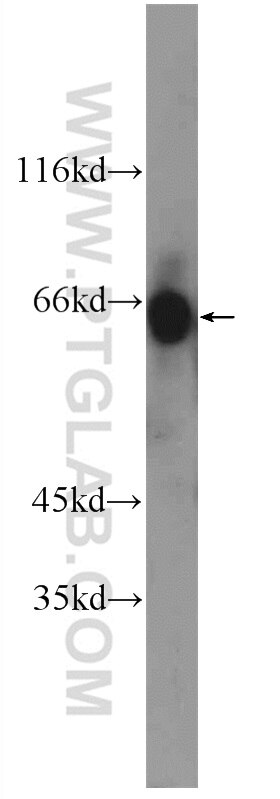 Western Blot (WB) analysis of A549 cells using ZIM3 Polyclonal antibody (25200-1-AP)