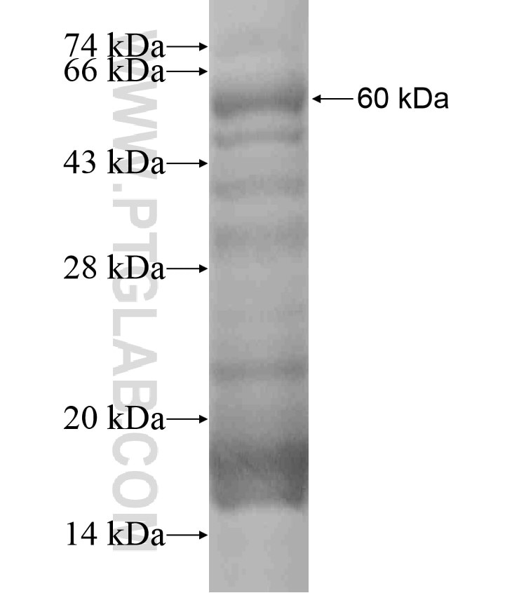 ZIM3 fusion protein Ag18411 SDS-PAGE