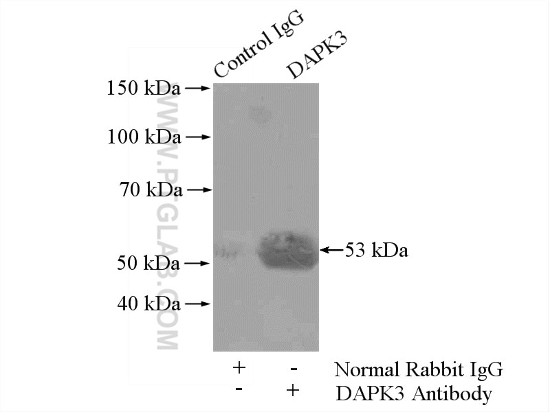 Immunoprecipitation (IP) experiment of HEK-293 cells using Phospho-ZIPK (Ser311) Polyclonal antibody (51021-1-AP)