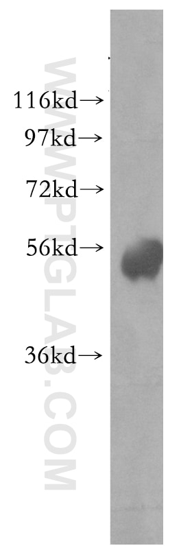 Western Blot (WB) analysis of HEK-293 cells using Phospho-ZIPK (Ser311) Polyclonal antibody (51021-1-AP)