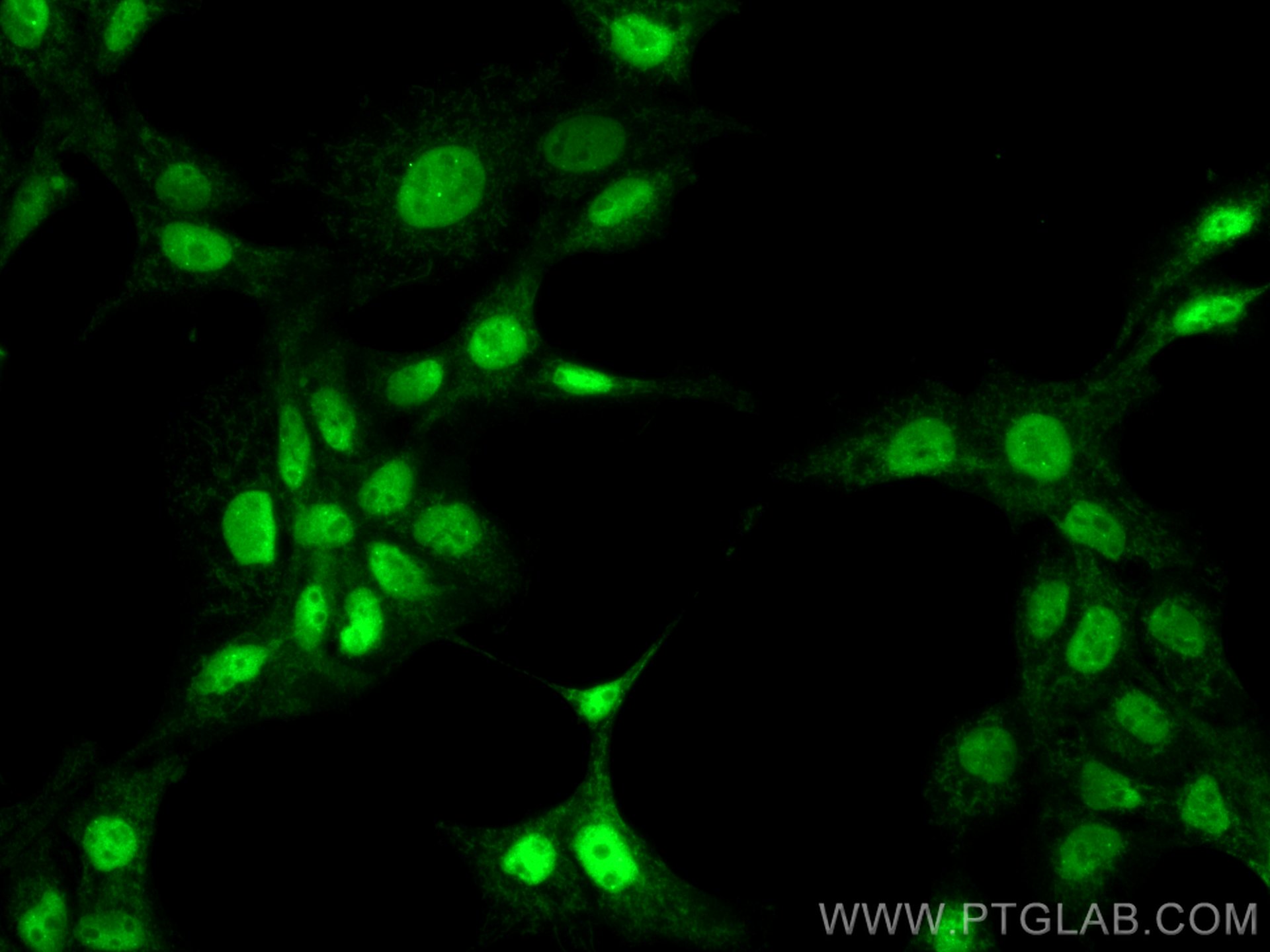Immunofluorescence (IF) / fluorescent staining of A431 cells using ZKSCAN1 Polyclonal antibody (25214-1-AP)