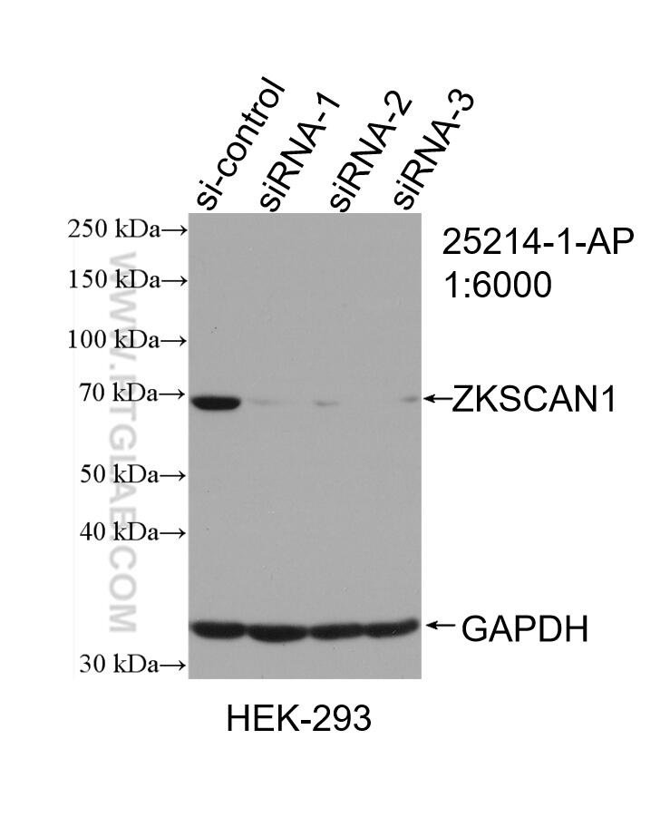 Western Blot (WB) analysis of HEK-293 cells using ZKSCAN1 Polyclonal antibody (25214-1-AP)