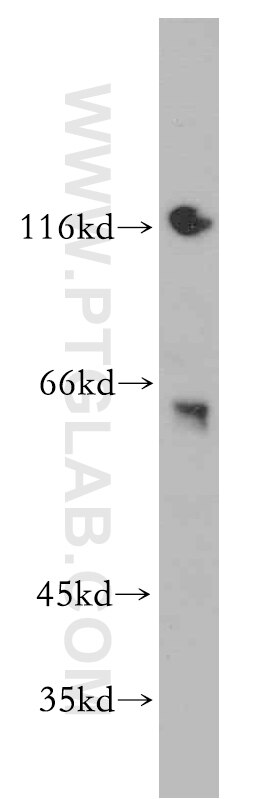 Western Blot (WB) analysis of mouse brain tissue using ZKSCAN3 Polyclonal antibody (20800-1-AP)