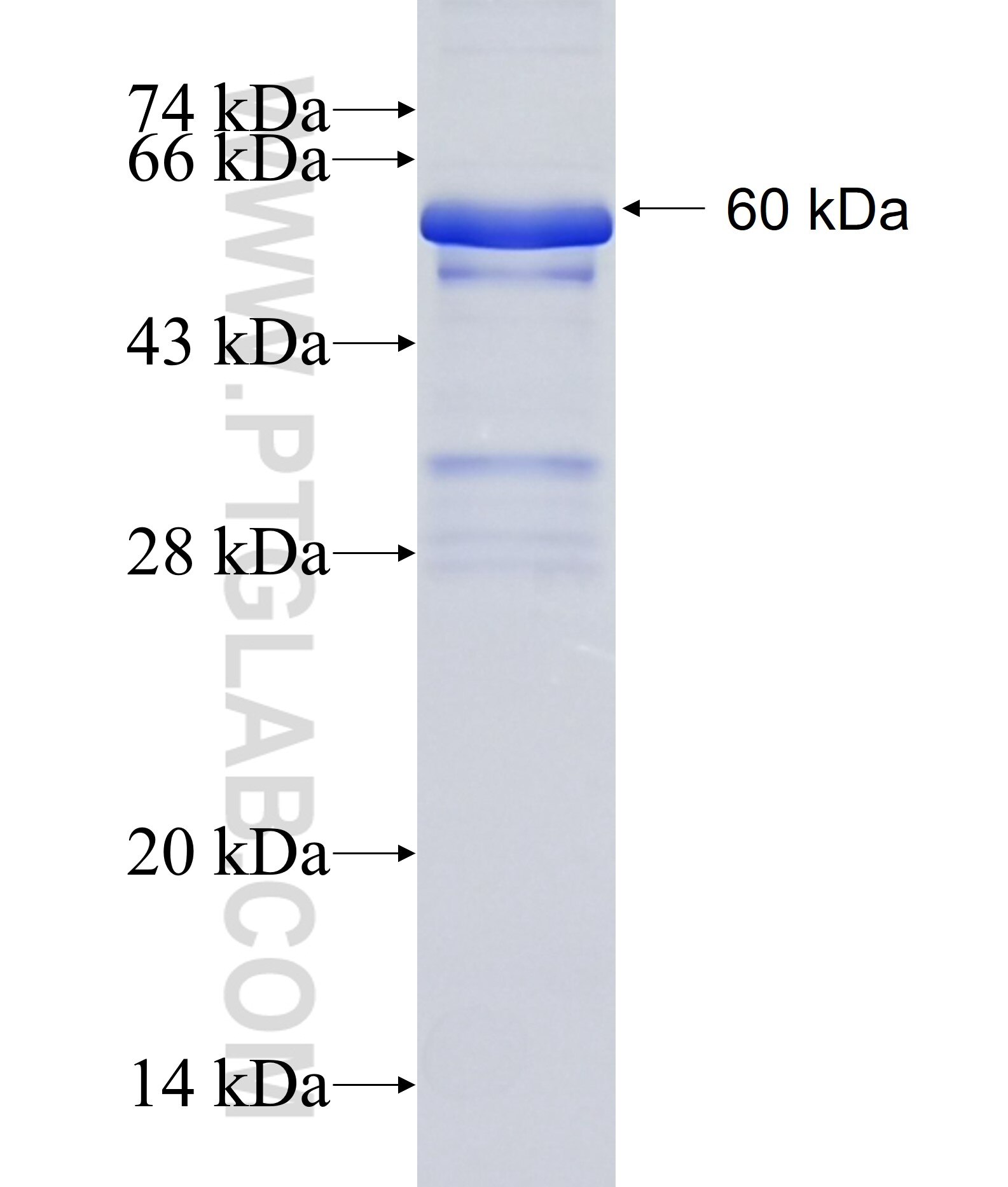 ZKSCAN3 fusion protein Ag14715 SDS-PAGE