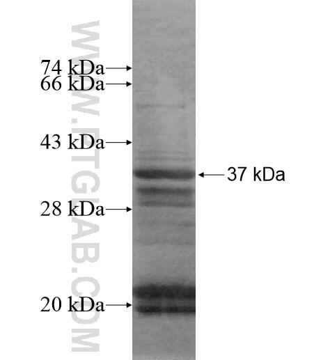 ZKSCAN3 fusion protein Ag14785 SDS-PAGE