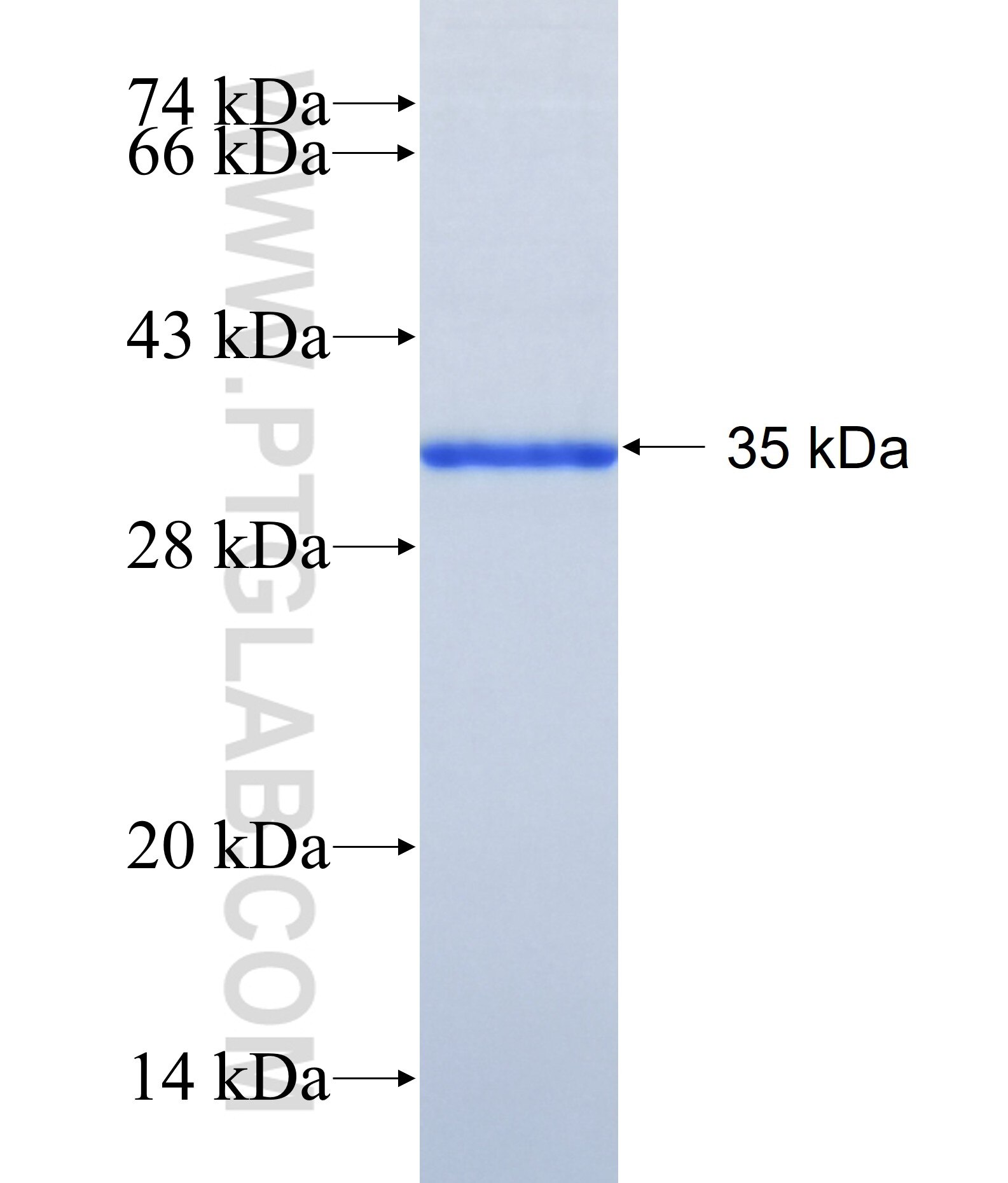 ZKSCAN4 fusion protein Ag41255 SDS-PAGE