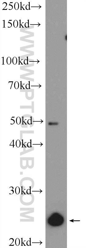Western Blot (WB) analysis of HeLa cells using ZMAT2 Polyclonal antibody (25819-1-AP)