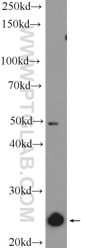 WB analysis of HeLa using 25819-1-AP