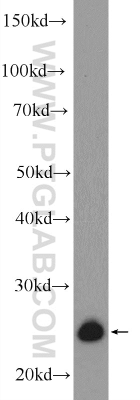 Western Blot (WB) analysis of SH-SY5Y cells using ZMAT2 Polyclonal antibody (25819-1-AP)