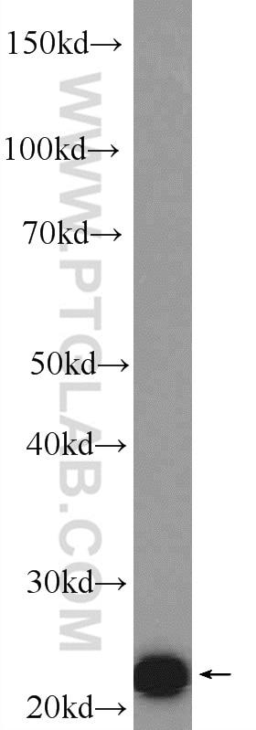 Western Blot (WB) analysis of Jurkat cells using ZMAT2 Polyclonal antibody (25819-1-AP)