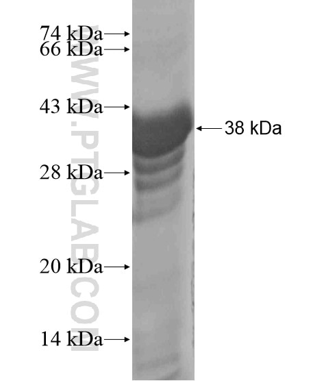 ZMAT3 fusion protein Ag20552 SDS-PAGE