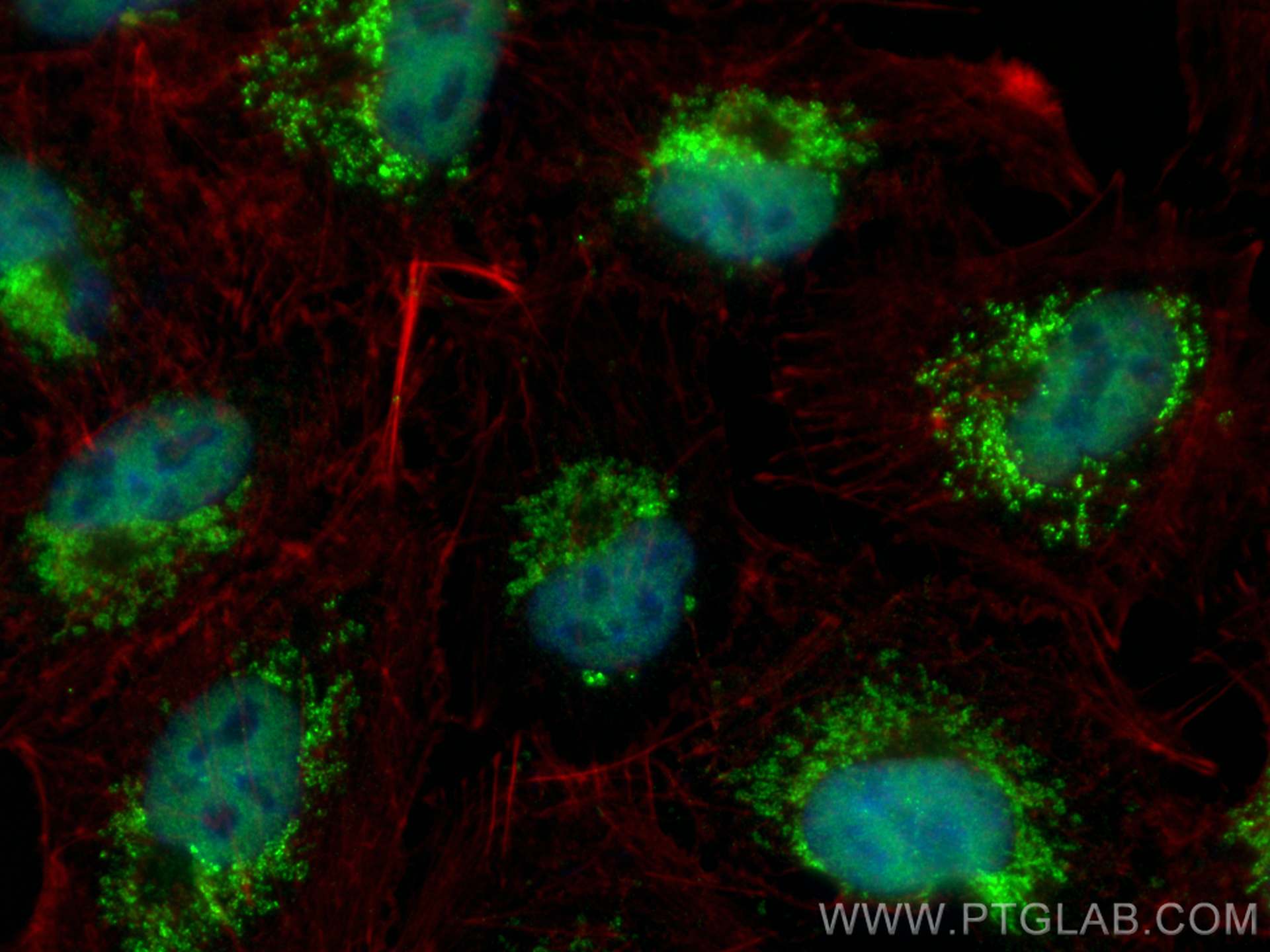 Immunofluorescence (IF) / fluorescent staining of A549 cells using ZMIZ1-Specific Polyclonal antibody (16159-1-AP)