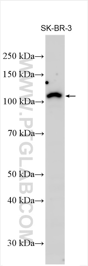 Western Blot (WB) analysis of various lysates using ZMIZ1-Specific Polyclonal antibody (16159-1-AP)