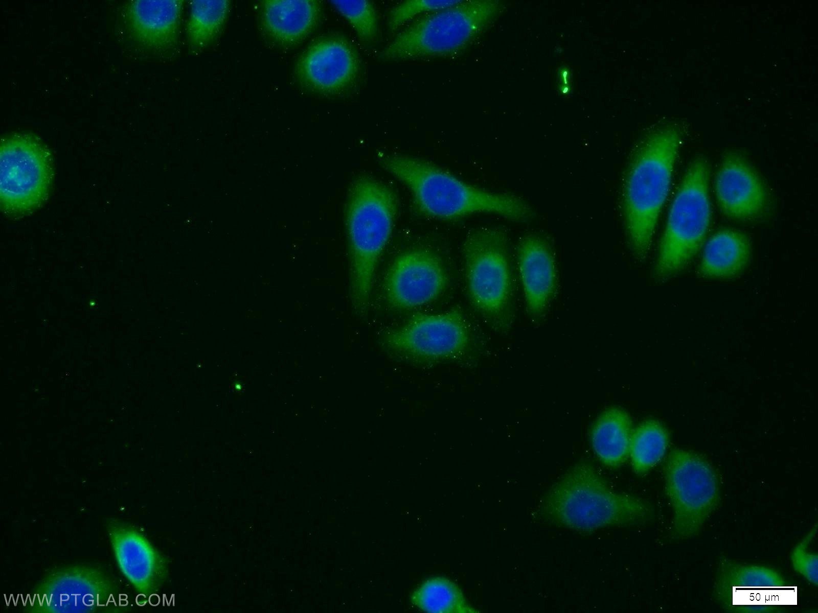 Immunofluorescence (IF) / fluorescent staining of PC-3 cells using ZMPSTE24 Polyclonal antibody (12847-1-AP)