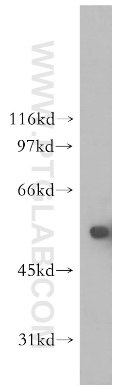 Western Blot (WB) analysis of PC-3 cells using ZMPSTE24 Polyclonal antibody (12847-1-AP)