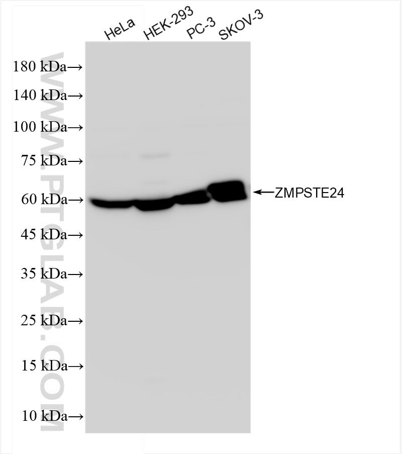 Western Blot (WB) analysis of various lysates using ZMPSTE24 Recombinant antibody (84547-1-RR)