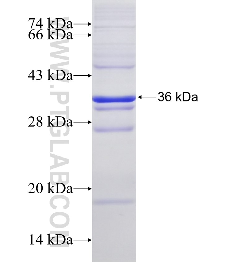 ZMPSTE24 fusion protein Ag3949 SDS-PAGE