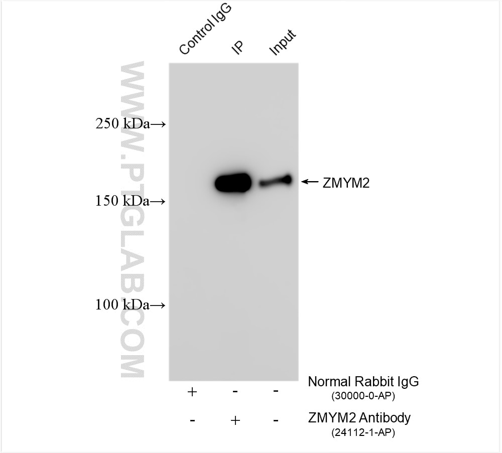IP result of anti-ZMYM2 (IP:24112-1-AP, 4ug; Detection:24112-1-AP 1:600) with Raji cells lysate 1320 ug. Immunoprecipitation (IP) experiment of Raji cells using ZMYM2 Polyclonal antibody (24112-1-AP)
