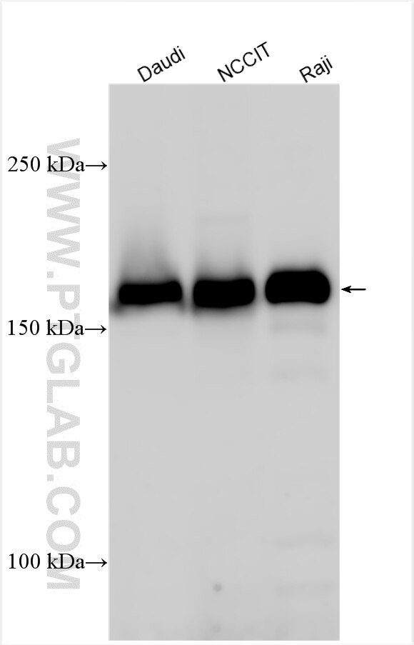 Various lysates were subjected to SDS PAGE followed by western blot with 24112-1-AP (ZMYM2 antibody) at dilution of 1:1000 incubated at room temperature for 1.5 hours. Western Blot (WB) analysis of various lysates using ZMYM2 Polyclonal antibody (24112-1-AP)