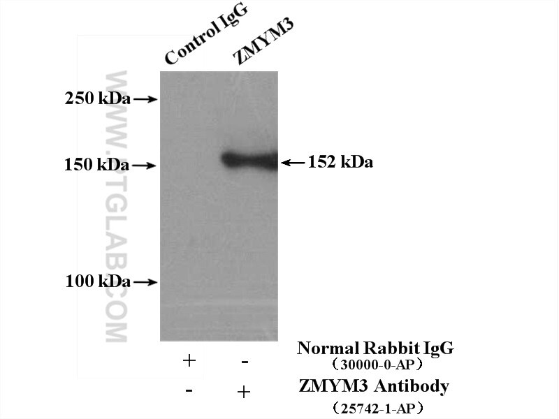 Immunoprecipitation (IP) experiment of K-562 cells using ZMYM3 Polyclonal antibody (25742-1-AP)