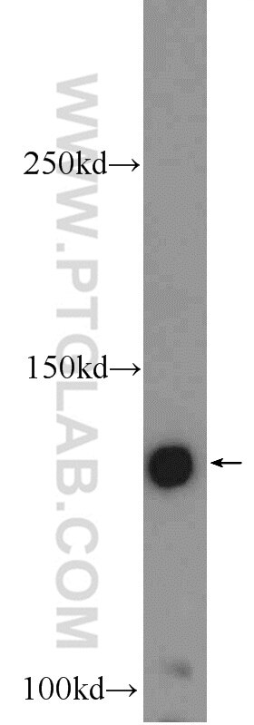 Western Blot (WB) analysis of mouse brain tissue using ZMYM3 Polyclonal antibody (25742-1-AP)