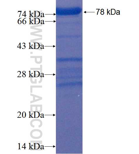 ZMYM3 fusion protein Ag22701 SDS-PAGE