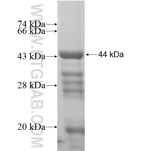 ZMYM4 fusion protein Ag15401 SDS-PAGE