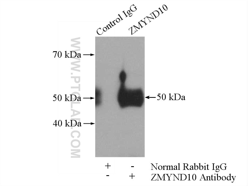 Immunoprecipitation (IP) experiment of SH-SY5Y cells using ZMYND10 Polyclonal antibody (14431-1-AP)