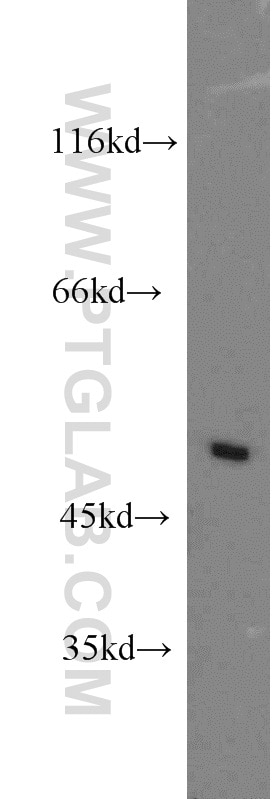 Western Blot (WB) analysis of SH-SY5Y cells using ZMYND10 Polyclonal antibody (14431-1-AP)
