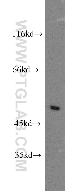 WB analysis of SH-SY5Y using 14431-1-AP