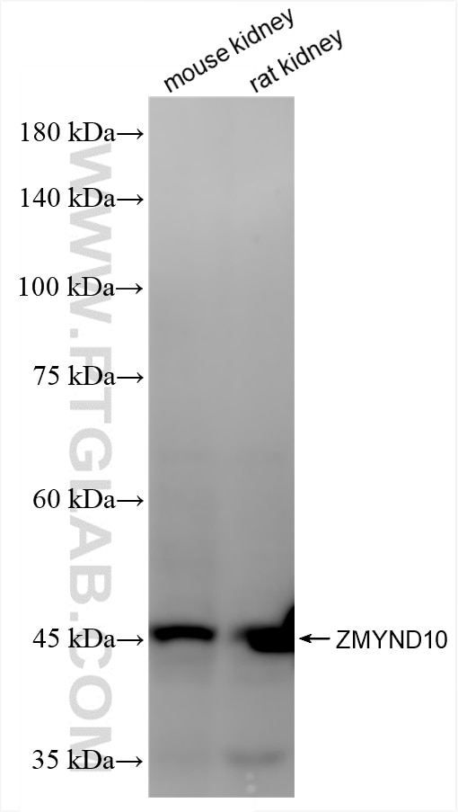 Western Blot (WB) analysis of various lysates using ZMYND10 Recombinant antibody (86430-1-RR)