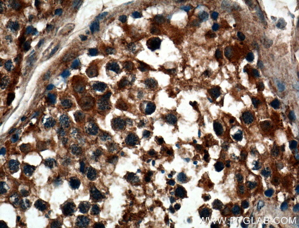 Immunohistochemistry (IHC) staining of human testis tissue using ZMYND12 Polyclonal antibody (25587-1-AP)