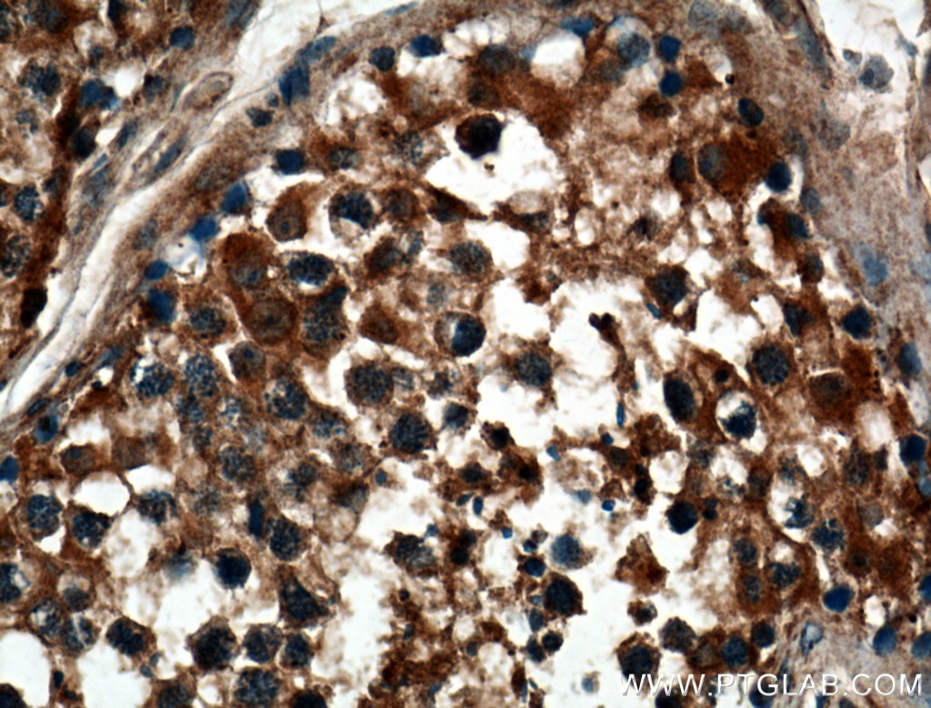 IHC staining of human testis using 25587-1-AP