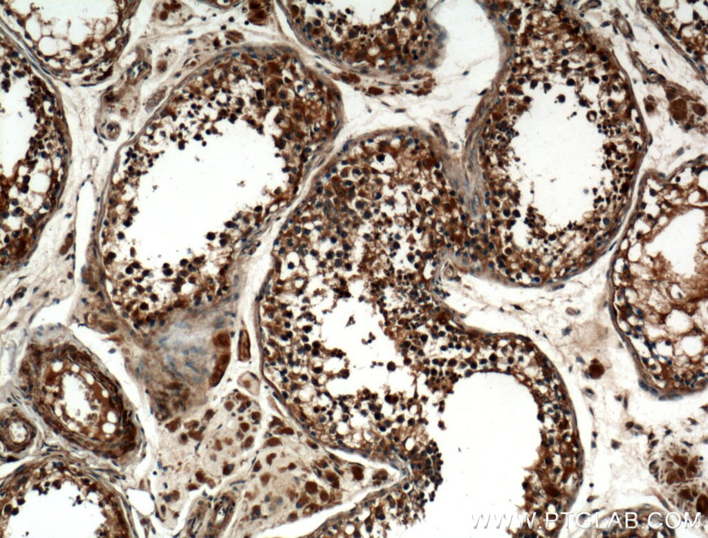 Immunohistochemistry (IHC) staining of human testis tissue using ZMYND12 Polyclonal antibody (25587-1-AP)